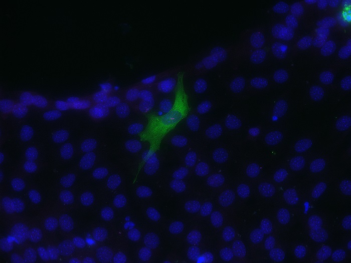 Arabidopsis-thaliana-trichome-Trevor-Rickerd Image